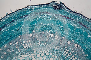 Stem cells of a lentil plant under the microscope.