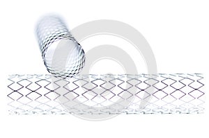 Stent photo