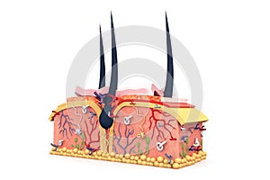 Stent angioplasty