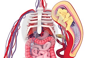 Stent angioplasty