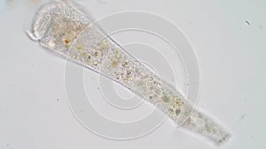 Stentor ciliate in waste water under the microscope.