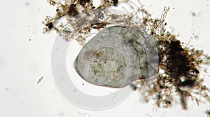 Stentor or trumpet animalcules is filter-feeding, heterotrophic protozoan ciliate photo