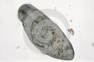 Stentor or trumpet animalcules is filter-feeding, heterotrophic protozoan ciliate moves in freshwater photo
