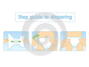 Step guide to diapering