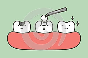 step of tooth amalgam filling by dental tools to protection decay tooth, before and after - teeth cartoon vector flat style