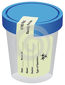 Sterile container with a label