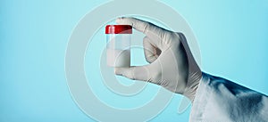 sterile container with some semen, web banner photo