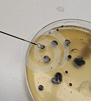 Bacteria Growing on Baird Parker Agar