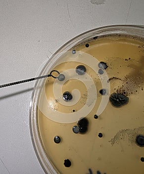 Bacteria Growing on Baird Parker Agar