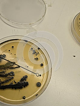 Bacteria Growing on Baird Parker Agar