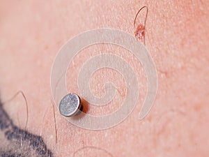 Sternum, cleavage, microdermal, surface piercing on collarbones. photo