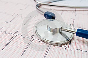 Stethoscope on ECG (electrocardiogram) chart