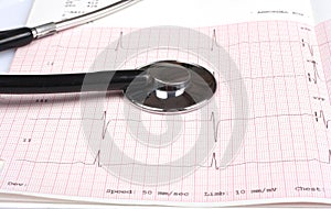 stethoscope and ecg graph