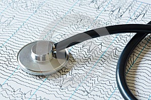 A stethoscope on EEG paper background photo