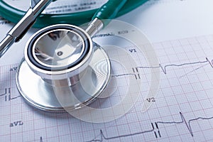 Stethoscope on an electrocardiogram (ECG) chart background