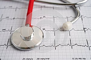 Stethoscope on electrocardiogram ECG, heart wave, heart attack, cardiogram report