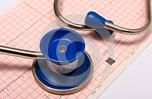 Stethoscope with electrocardiogram graph report