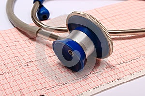 Stethoscope with electrocardiogram graph report