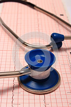 Stethoscope with electrocardiogram graph report