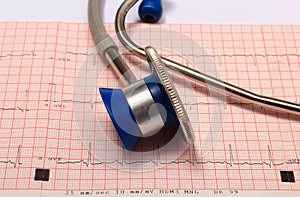 Stethoscope with electrocardiogram graph report