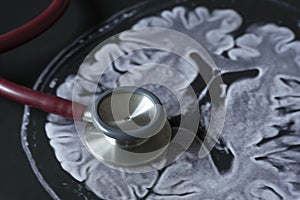 Stethoscope and picture of brain MRI