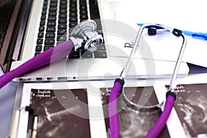 Stethoscope resting on a computer keyboard -
