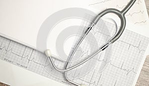 A stethoscope on the top of the EKG chart