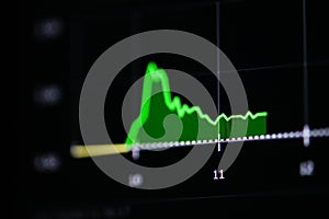 Stock market graph on screen