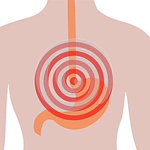 Stomach ache in Human body. Abdominal pain. Heartburn.