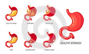 Stomach diseases concept in flat style, vector