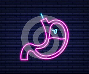 Stomach endoscopy. Endoscope in stomach through esophagus. Neon style. Vector illustration.