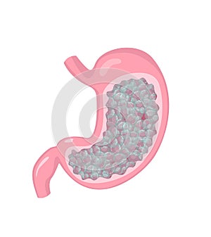 Stomach with gas and bloating feeling. Human internal organ disorder pathology.