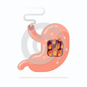 Stomach heartburn concept flat