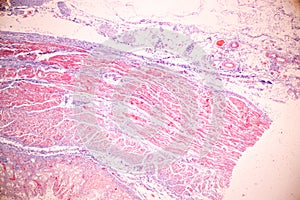 Tissue of Stomach Human under the microscope in Lab.