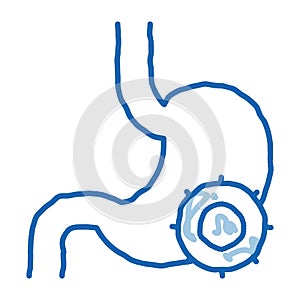 Stomach Infection doodle icon hand drawn illustration