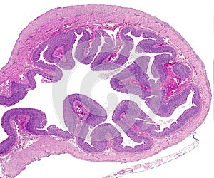 Stomach. Layers of the gastric wall