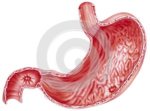 Stomach - Peptic Ulcers