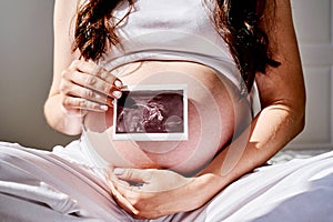 the stomach of a pregnant woman in close-up with an ultrasound image