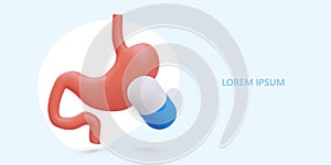 Stomach treatment. Gastritis, ulcer, inflammation, flora disturbance