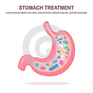 Stomach treatment. Pills, medicine, drugs and internal organ. Digestive system, tract. Painkiller, tablet, vitamine