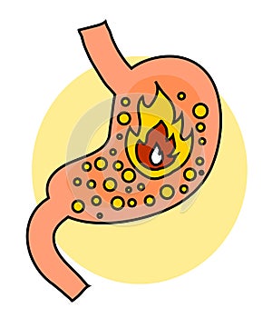 Stomach on a white background. Heartburn. An object.