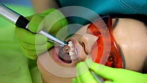 Stomatologist polishing fresh sealant, cosmetic dentistry for chipped tooth