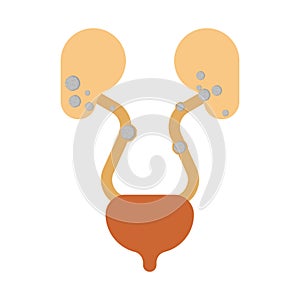 Stones in kidneys. Nephrolithiasis kidney stones disease. Medical Vector illustration photo