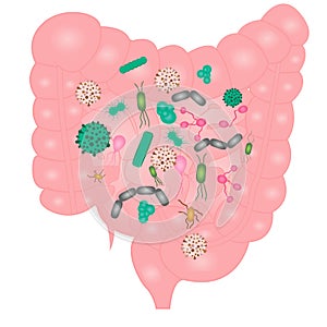 Stop Bacterial overgrowth in small intestine