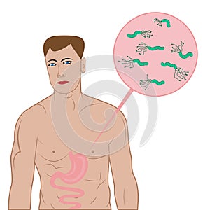 Stop helicobacter in stomach sign