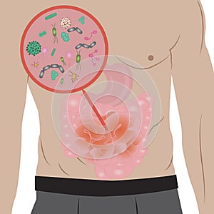 Stop infection overgrowth in intestine vector illustration