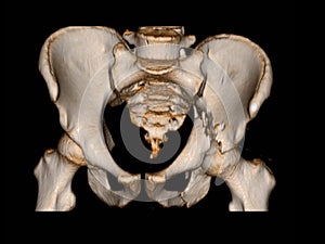 Stop motion of body parts CT Pelvis Bone 3D rendering image isolated on black background showing