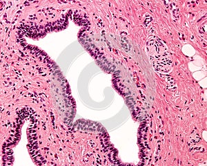 Stratified columnar epithelium photo