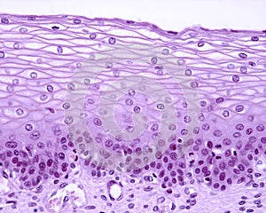 Stratified squamous epithelium photo