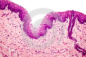 Stratified squamous epithelium photo